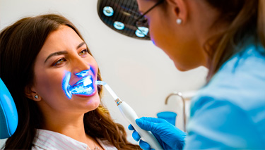 Blanqueamiento:  ¿Es perjudicial para la salud de tus dientes?