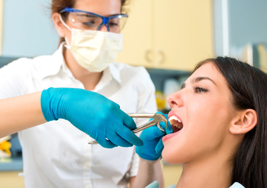 El Proceso de una Extracción Dental: Un Recorrido Detallado