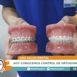Realizamos un Control de Ortodoncia en vivo para Canal 9 Bío Bío Televisión