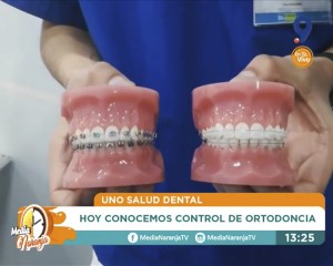 Realizamos un Control de Ortodoncia en vivo para Canal 9 Bío Bío Televisión
