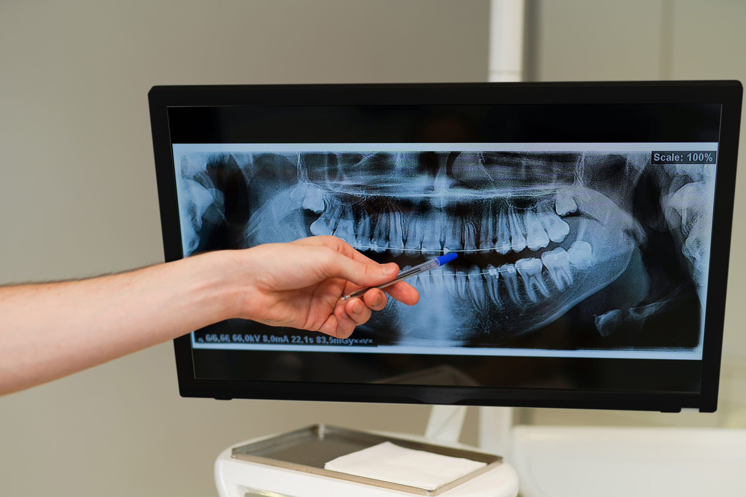 Radiografías Dentales
