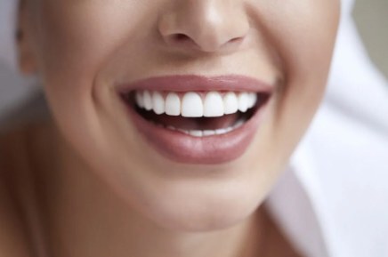 Precios implantes dentales