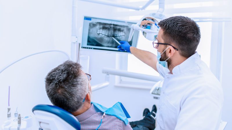 ¿Qué es un implante dental?: Todo lo que debes saber
