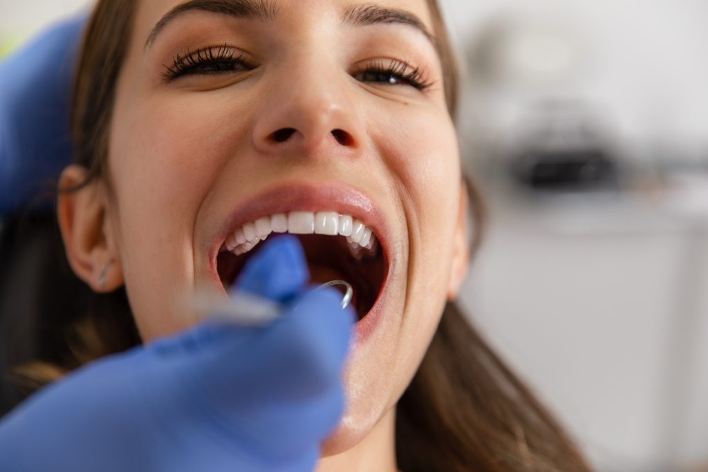 Limpieza de dientes: ¿Cuándo debes hacerla?