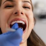 Limpieza de dientes: ¿Cuándo debes hacerla?