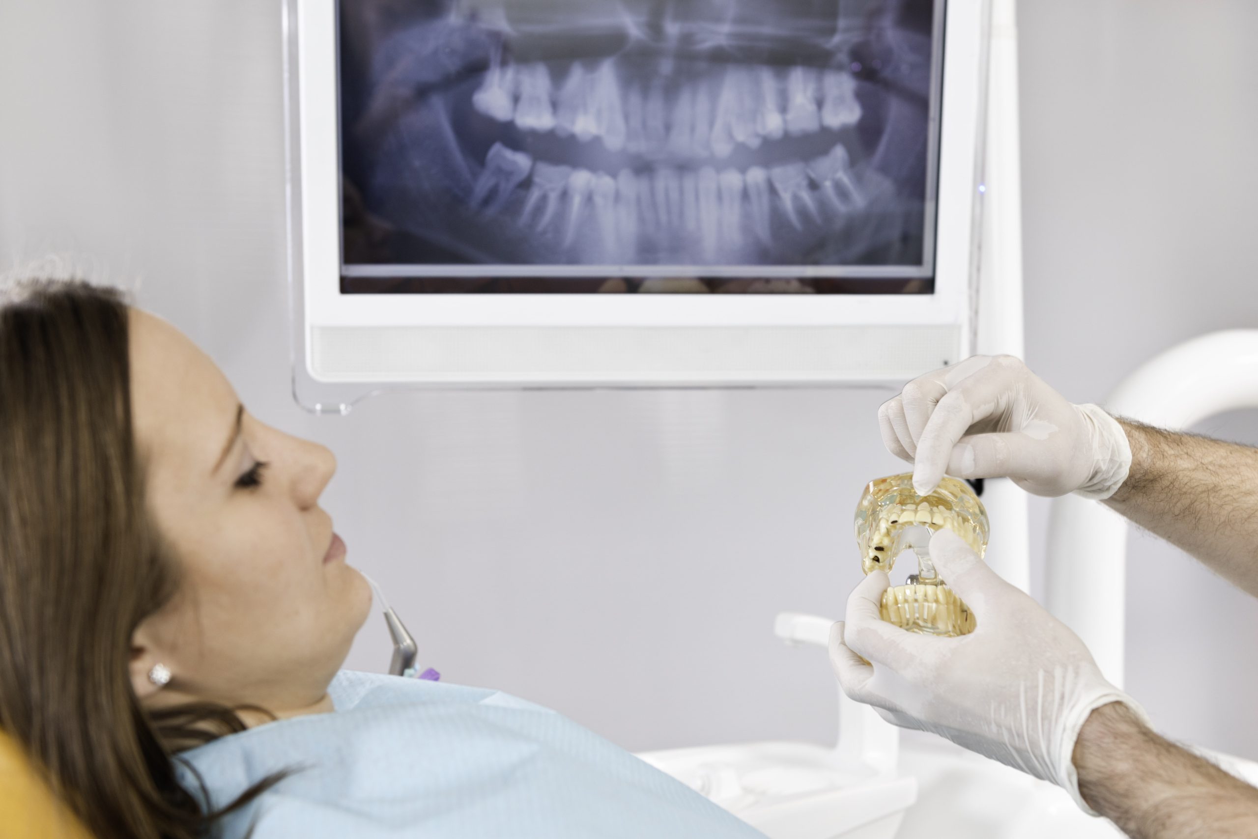 Tipos de radiografías dentales: ¿Para qué sirven?