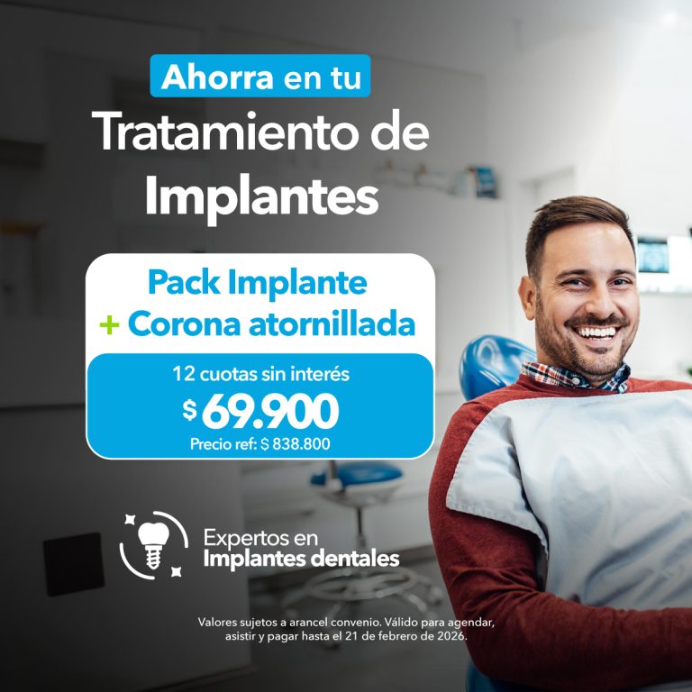 Always On Implante – Enero 2026