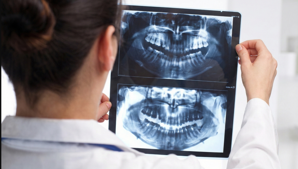 Tipos de radiografías dentales: ¿Para qué sirven?