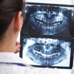 Tipos de radiografías dentales: ¿Para qué sirven?