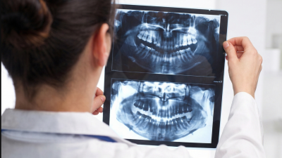 Tipos de radiografías dentales: ¿Para qué sirven?