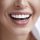 ¿Qué son las carillas dentales?: Transforma tu sonrisa