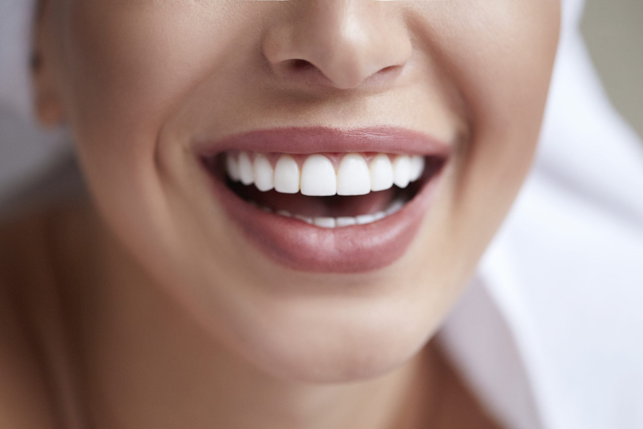 ¿Qué son las carillas dentales?: Transforma tu sonrisa