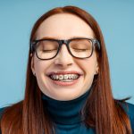 Tratamiento de ortodoncia en adultos: Sonrisas alineadas a cualquier edad