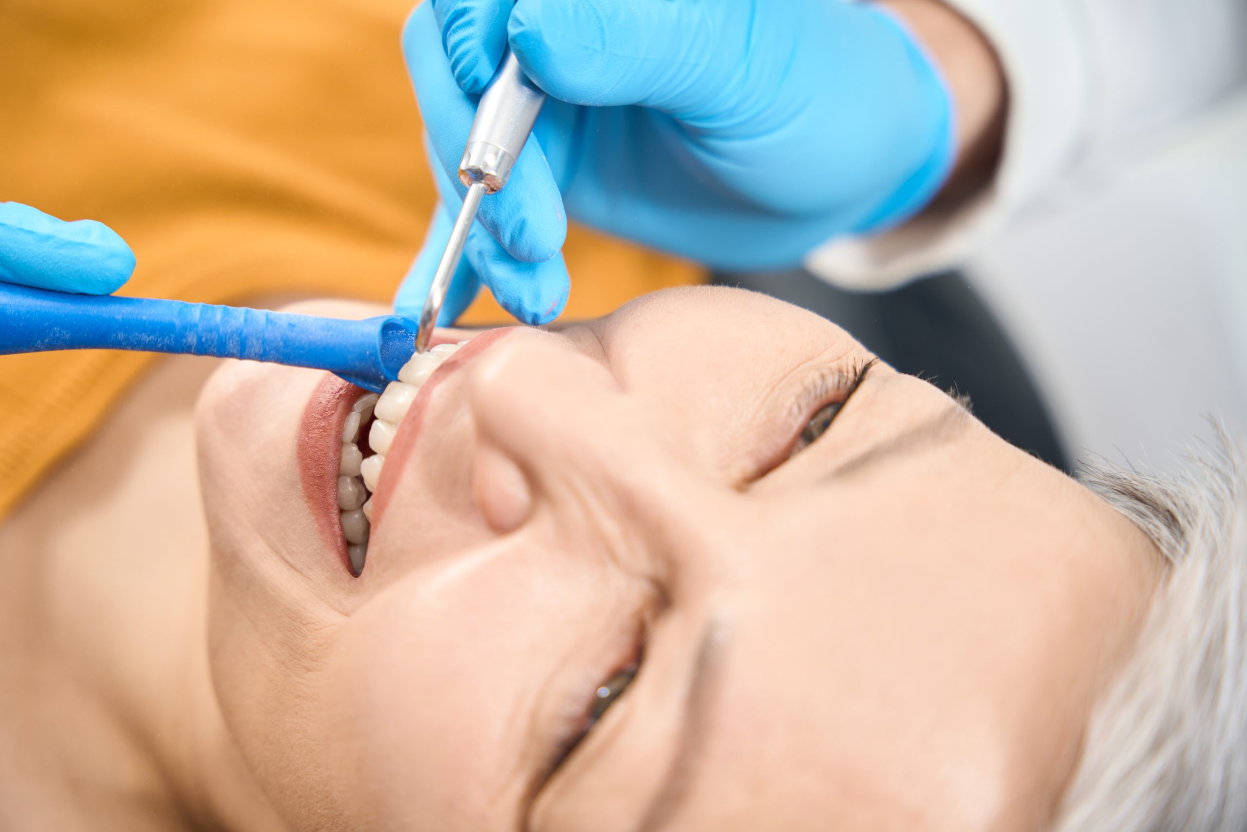 Mujer en tratamiento de limpieza dental