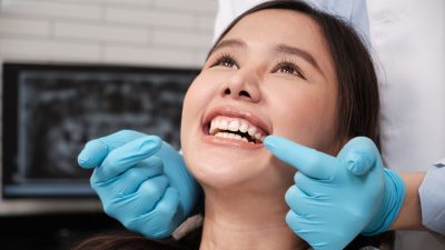 Limpieza y blanqueamiento dental: diferencias, beneficios y cuándo elegir cada uno