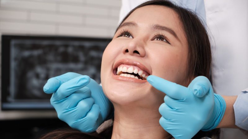 Limpieza y blanqueamiento dental: diferencias, beneficios y cuándo elegir cada uno