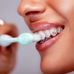 Cepillo de dientes para brackets: cómo elegir el ideal para tu sonrisa