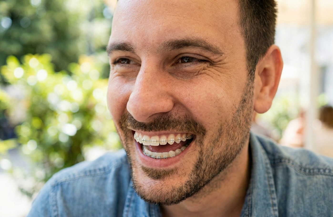 ortondoncia en adultos