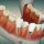 Nuevas tecnologías dentales para atrofia ósea