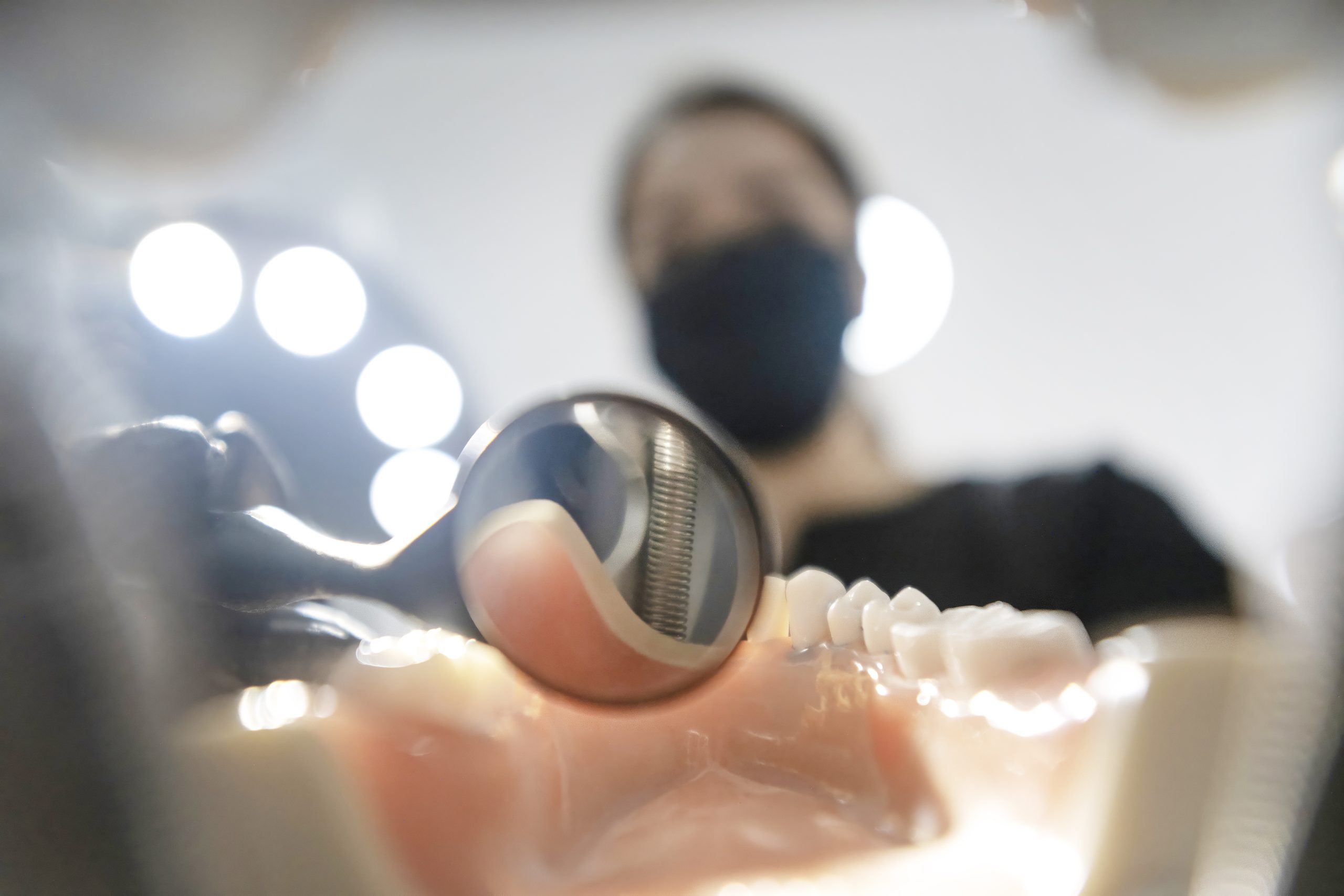 Tratamiento de implante dental unitario