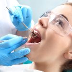 ¿Cuánto tiempo dura una endodoncia?: Lo que debes saber