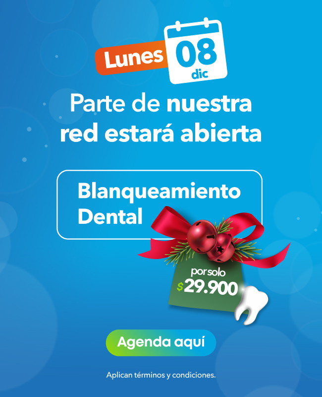 Promoción Limpieza y Blanqueamiento Diciembre