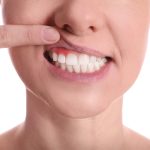 Periodontitis: riesgos y consecuencias
