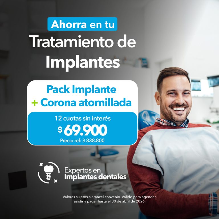 Implantes AON