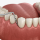Limpieza dental profunda: qué es, cuándo se necesita y cómo se hace