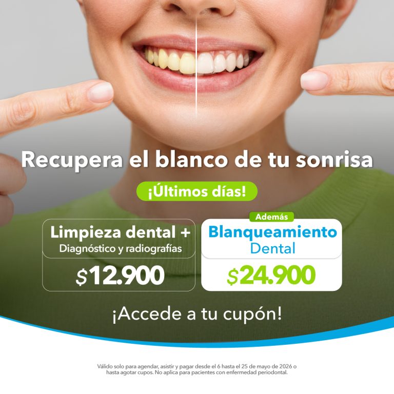 LIMPIEZA + BLANQUEAMIENTO MAY 26