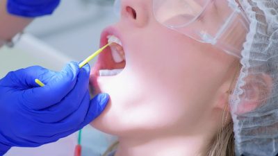 Flúor dental: qué es, para qué sirve y cuáles son sus beneficios para tu sonrisa