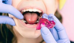 Ortodoncia interceptiva en niños: guía completa para cuidar su desarrollo dental