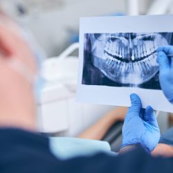 Cropped head close up of man dentist holding picture of female teeth during her visit to clinic